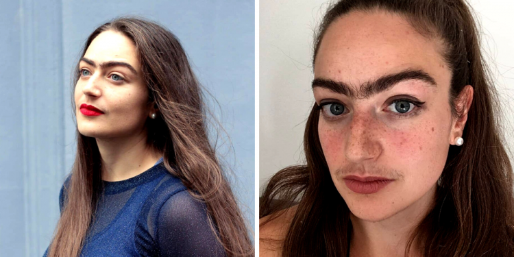 She Has Stopping Facial Hair Removal & You Will Be Surprise By Looking at Her Beauty Now