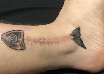 Cover Up Scars And Birthmarks, with Tattoos