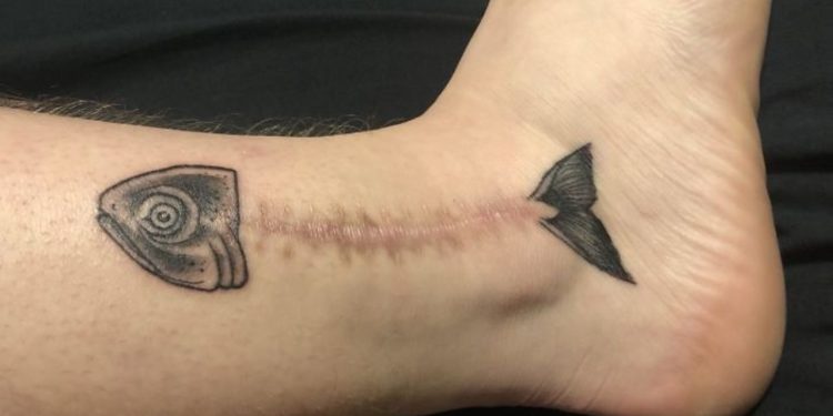 Cover Up Scars And Birthmarks, with Tattoos