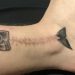 Cover Up Scars And Birthmarks, with Tattoos